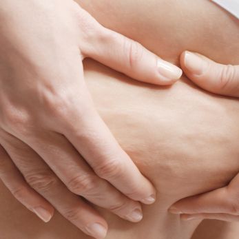 skóra-cellulit-tłuszczowy